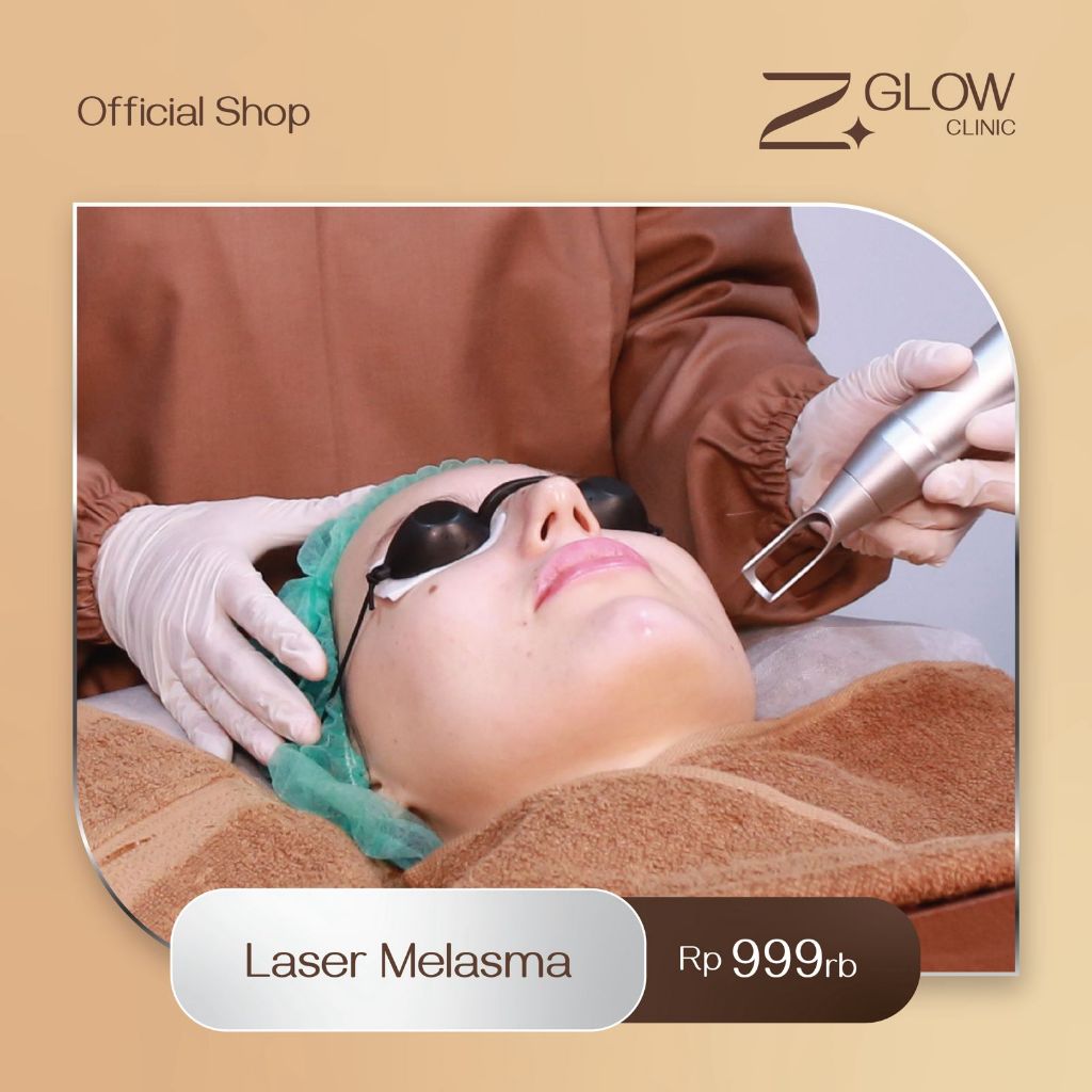 ZGLOW LASER MELASMA