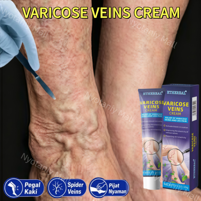 Varicose veins cream Salep varises paling ampuh Salep Penghilang Varises Vaskulitis Penghilang Varis