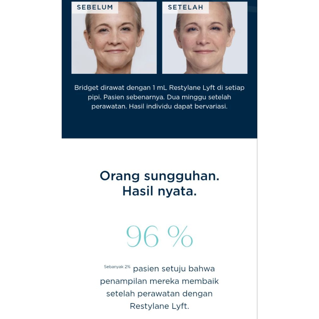 RESTYLANE LIFT Dermal filler  by EROPA