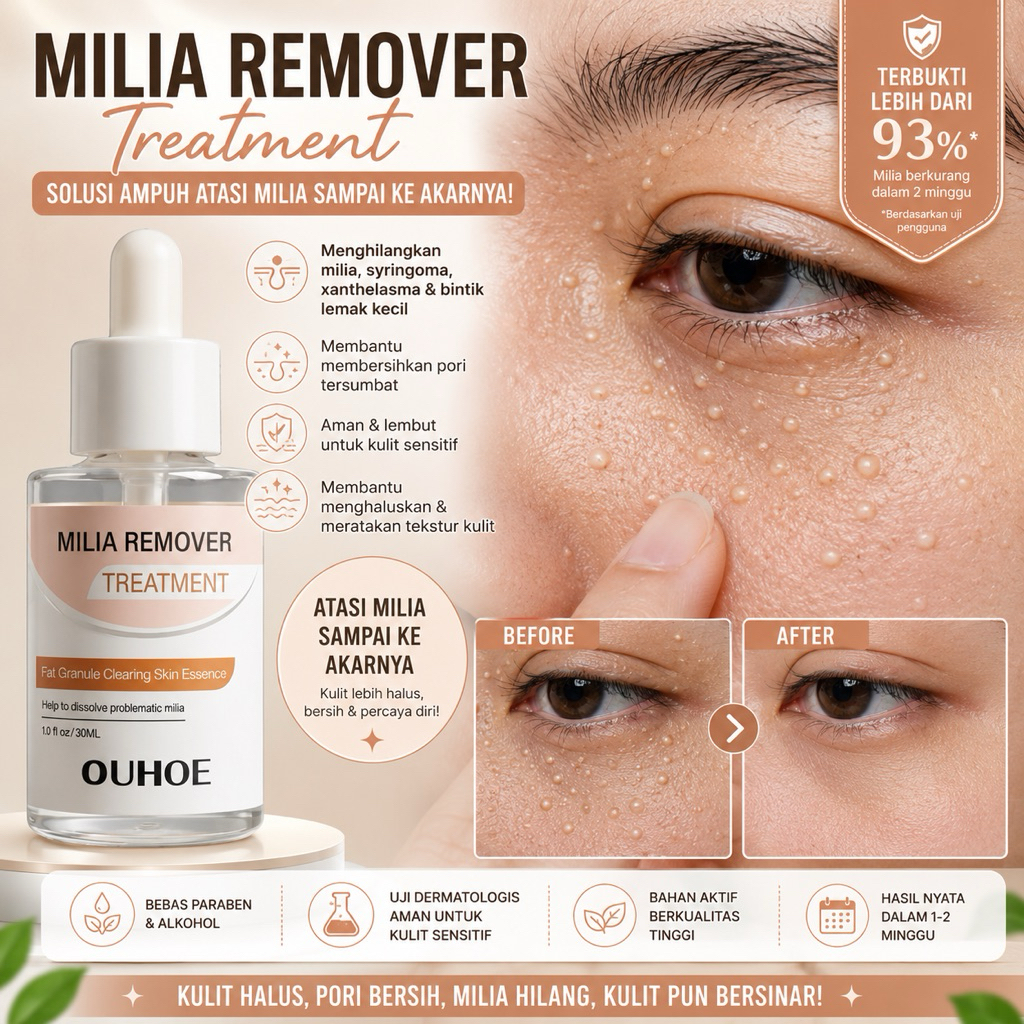 Milia Remover Serum Penghilang Perontok Milia Bintik Putih Mata Ouhoe Milia Remover Treatment Oil-Fr