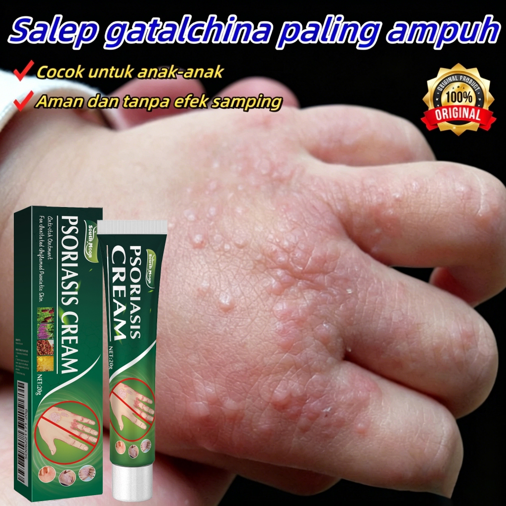 Salep Eksim Kering dan Gatal Salep Gatal China Paling Ampuh Obat Gatal Selangkangan Salep Bayi Untuk