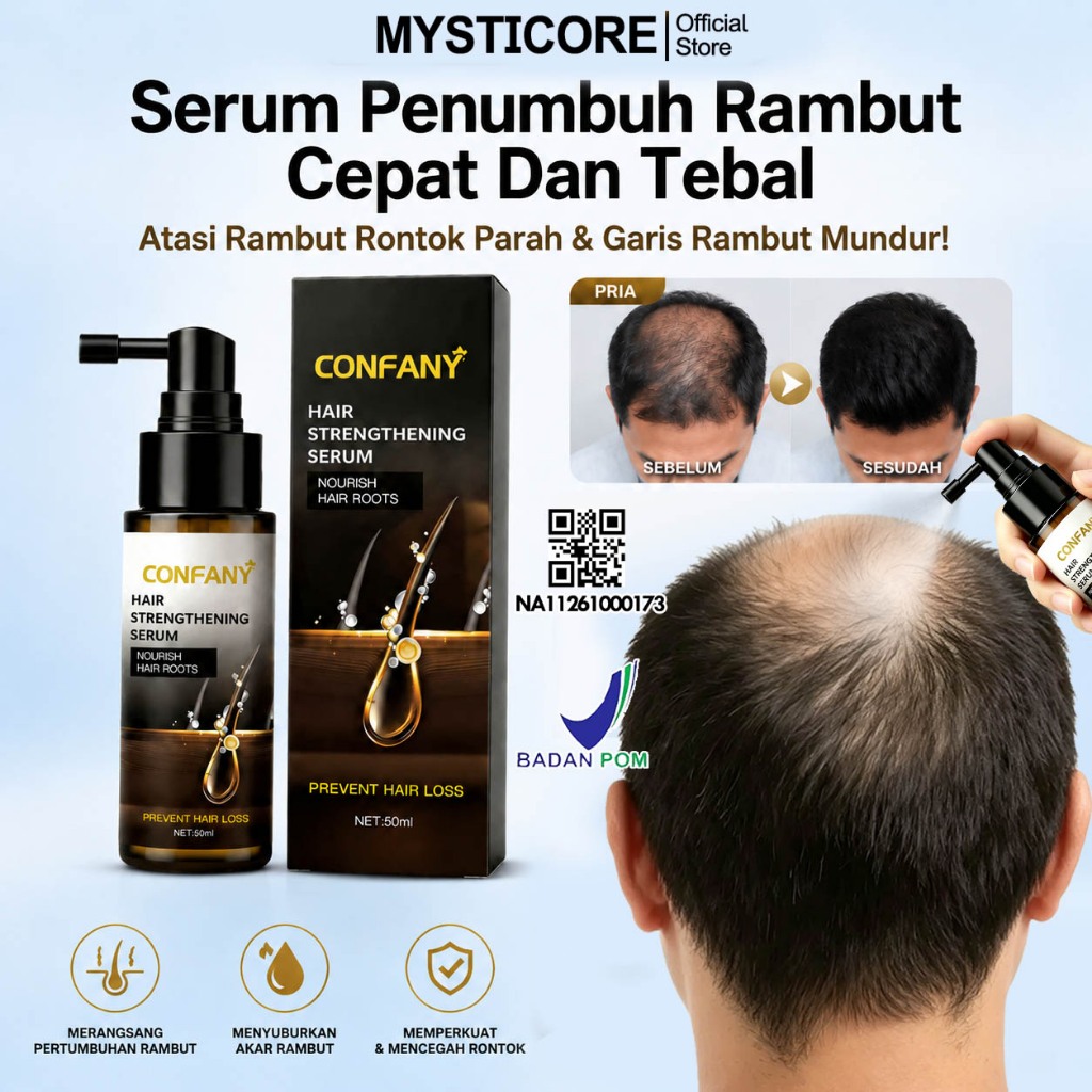 Semprotan Penumbuh Rambut Hair Growth Spray Anti Rontok Serum Penebal Rambut Obat Rambut Botak Meneb