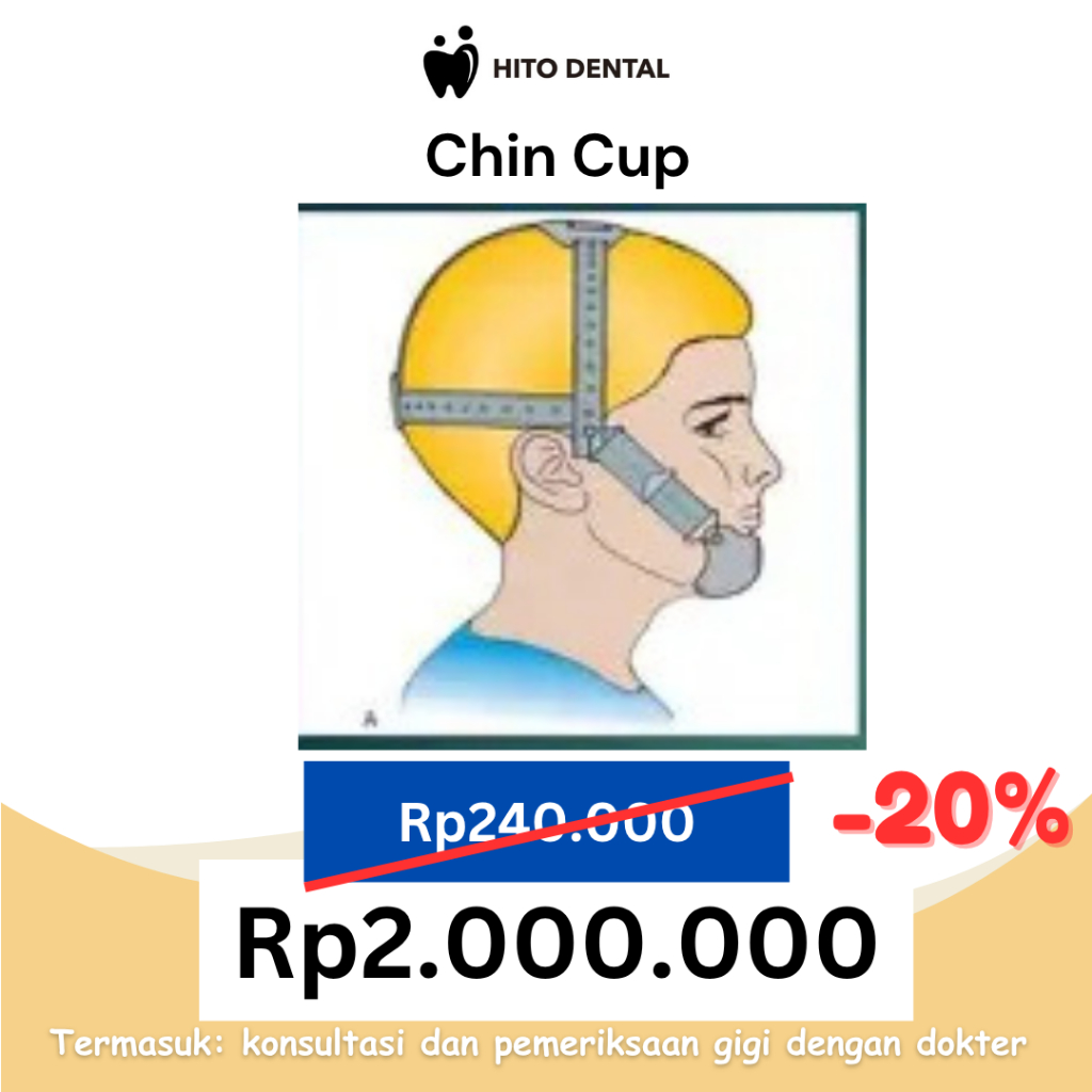Chin Cup+konsultasi dokter dan pemeriksaan kamera intra oral