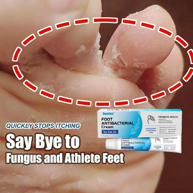 Salep kaki rayapan dan bau 0bat kaki rayapan Kaki gatal kering 0bat Jamur Kaki Salep kaki pecah peca