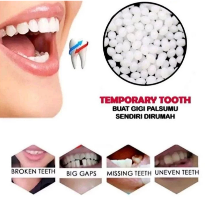 Temptooth Penambal Gigi Berlubang, Gigi Bolong, Gigi Patah, Mudah Dibentuk Sendiri di Rumah | READY 