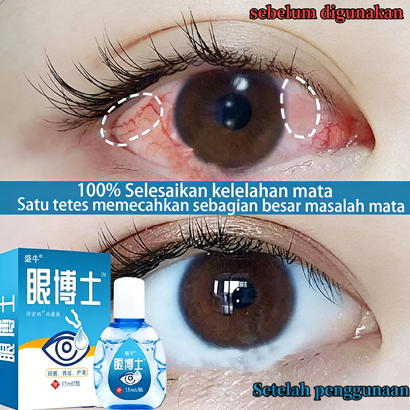 tetes mata obat tetes mata obattetes mata ampuh tetes mata katarak tetes mata rohto