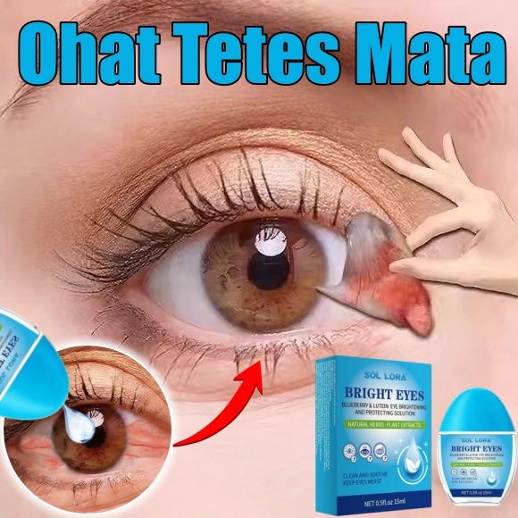 Obat Tetes Mata Tetes Mata Minus Paling Ampuh Tetes Mata Katarak Obat Mata Merah Eye Drop Sakit Mata