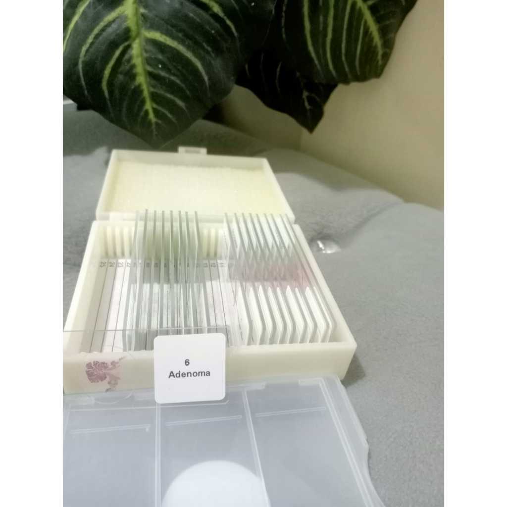 Preparat Adenoma ( Tumor Jinak )-china