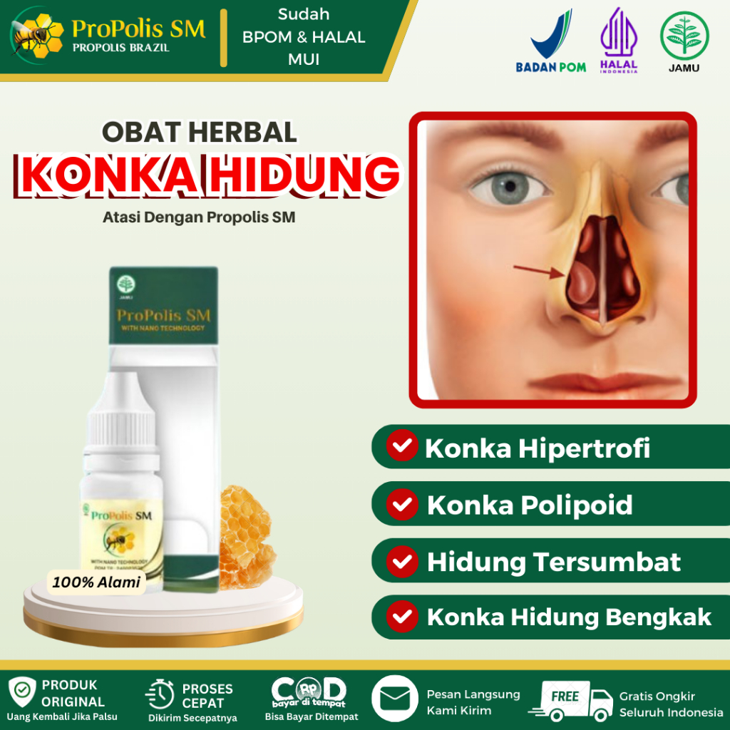 Obat Konka Hidung Bengkak, Benjolan Di Rongga Hidung, Konka Hidung Membesar, Konka Hipertrofi, Konka