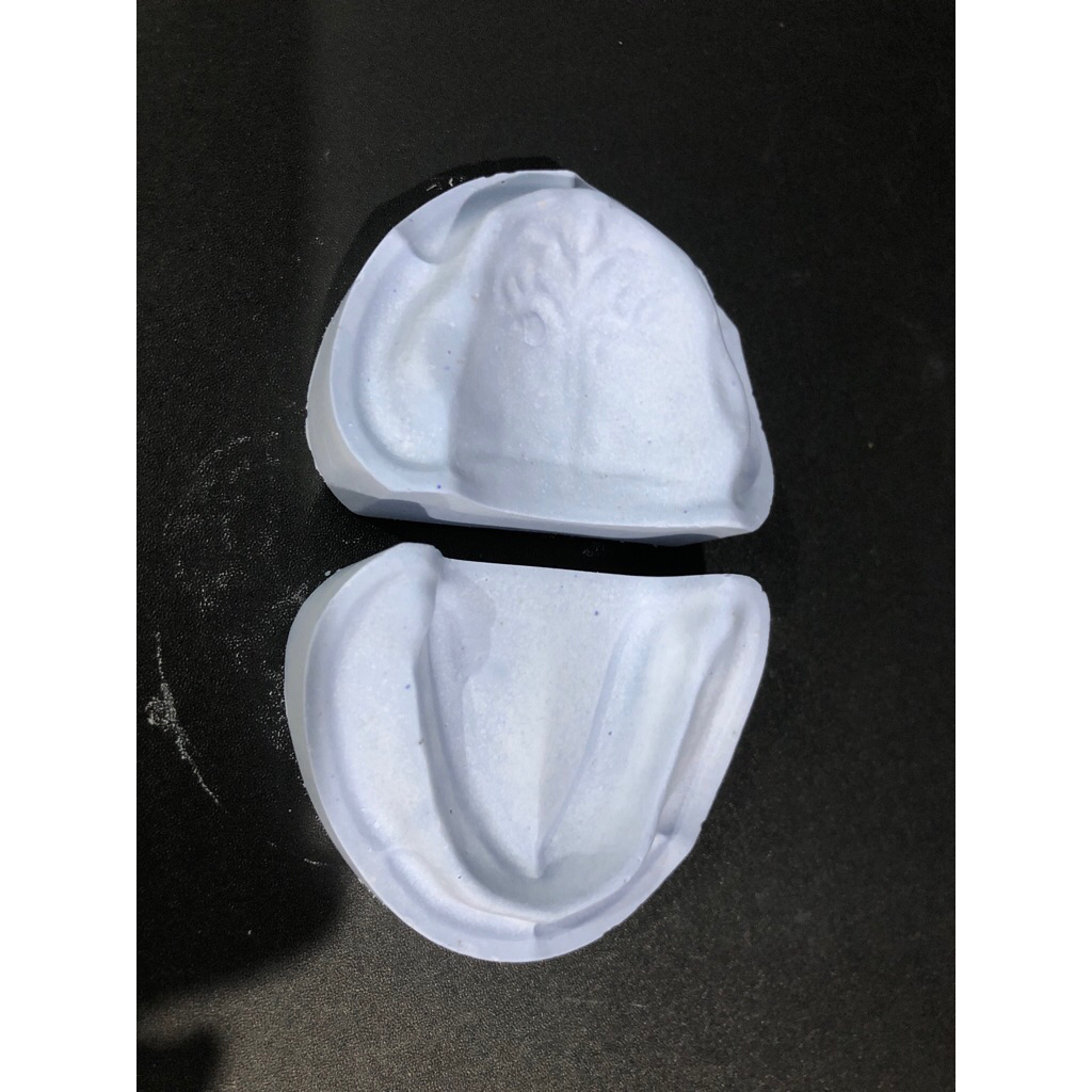 Model gigi edentulous gips biru