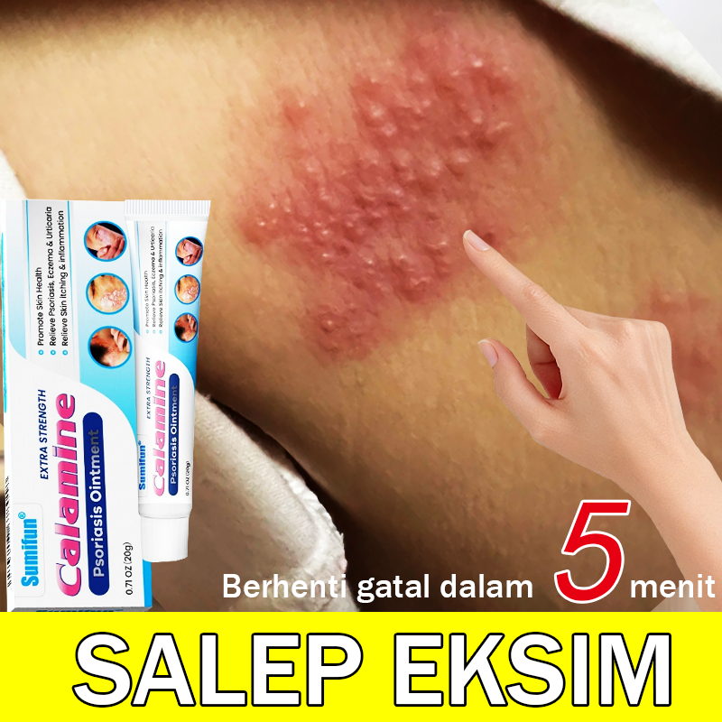 salep gatal salep eksim kering dan gatal salep jamur oba gatal paling ampuh psoriasis eksim dermatit