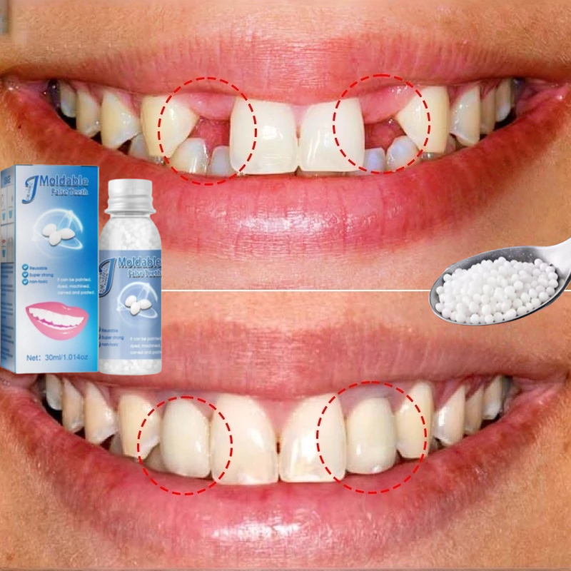 Tambal gigi Penambal gigi berlubang Lem gigi Butiran penambal gigi Tambal Gigi Permanen Super Kuat B