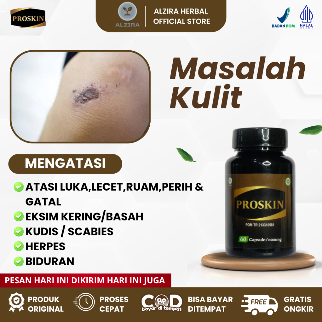 Proskin –  Obati Koreng, Luka,Lecet,Ruam,Perih & Gatal - Gatal