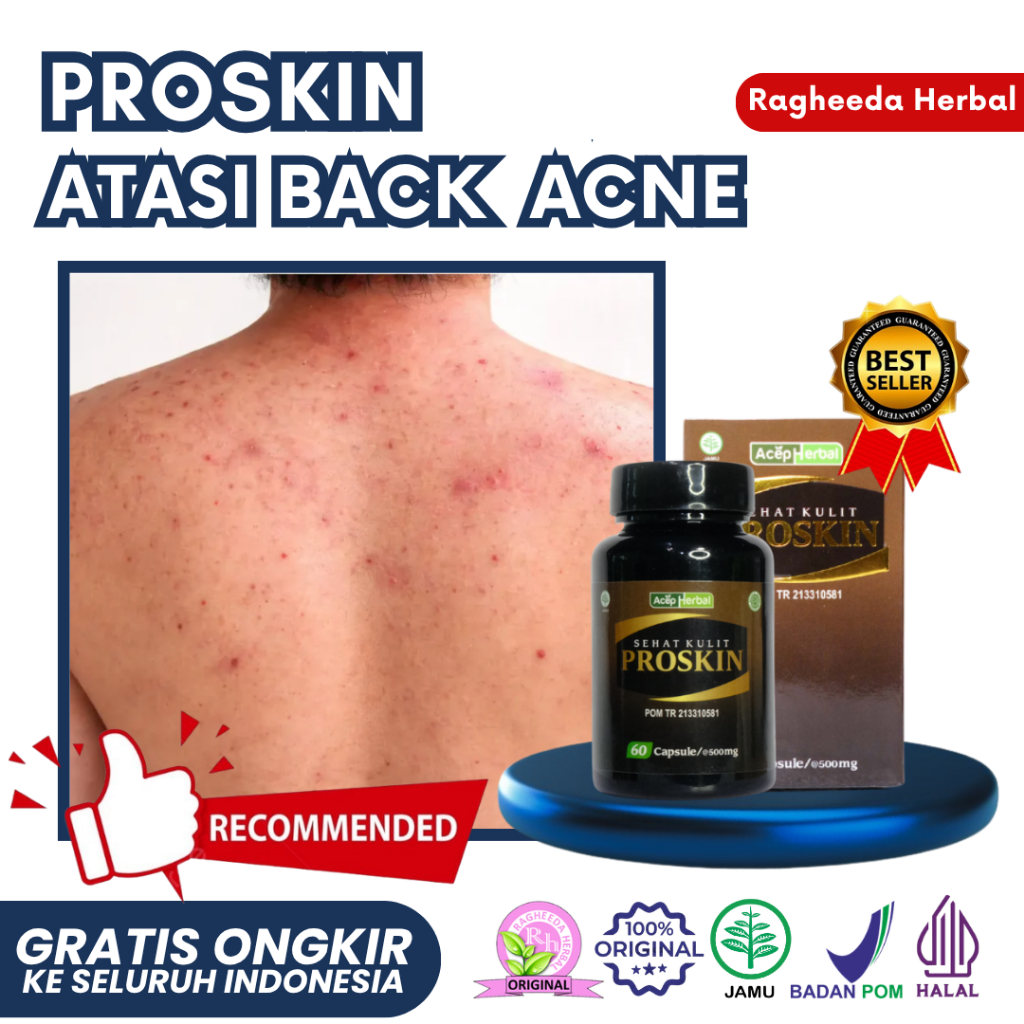 Obat Jerawat Badan, Punggung, Dada, Bahu, Penyakit Back Acne / Bacne - Suplemen Kesehatan Kulit Mera