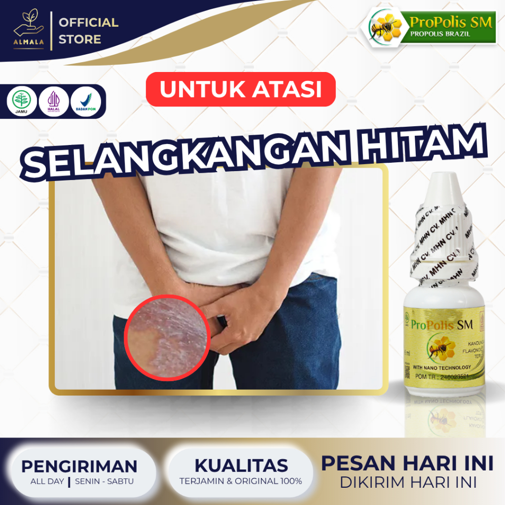 Obat Selangkangan Hitam, Memutihkan Selangkangan Hitam, Pembersih Jamur Selangkangan, Koreng di Sela
