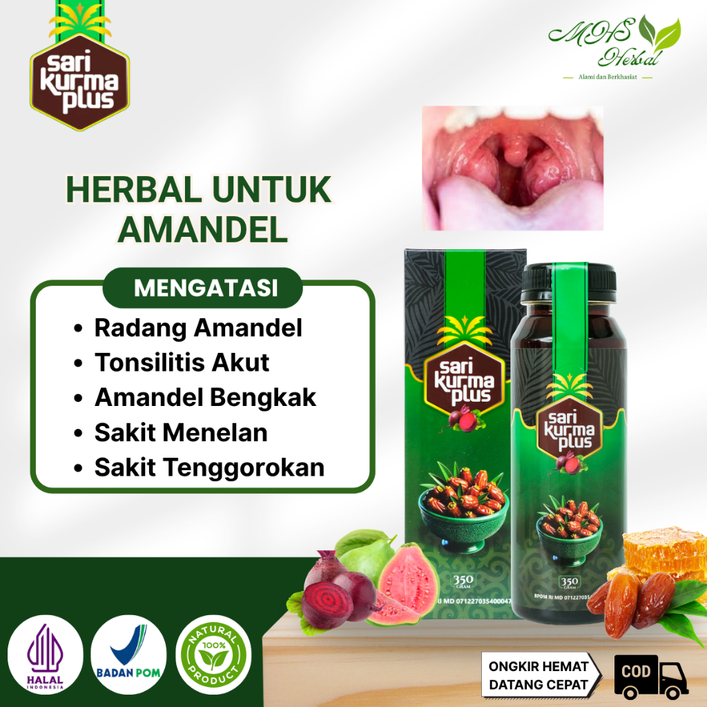 Obat Amandel, Tonsilitis Akut, Radang Amandel, Pembengkakan Amandel, Sakit Menelan, Sakit Tenggoroka