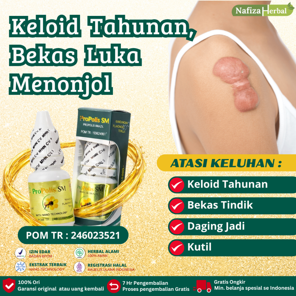 Obat Keloid Daging Tumbuh Menahun Penghilang Bekas Luka Operasi Lama, Obat Keloid, Penghilang Bekas 
