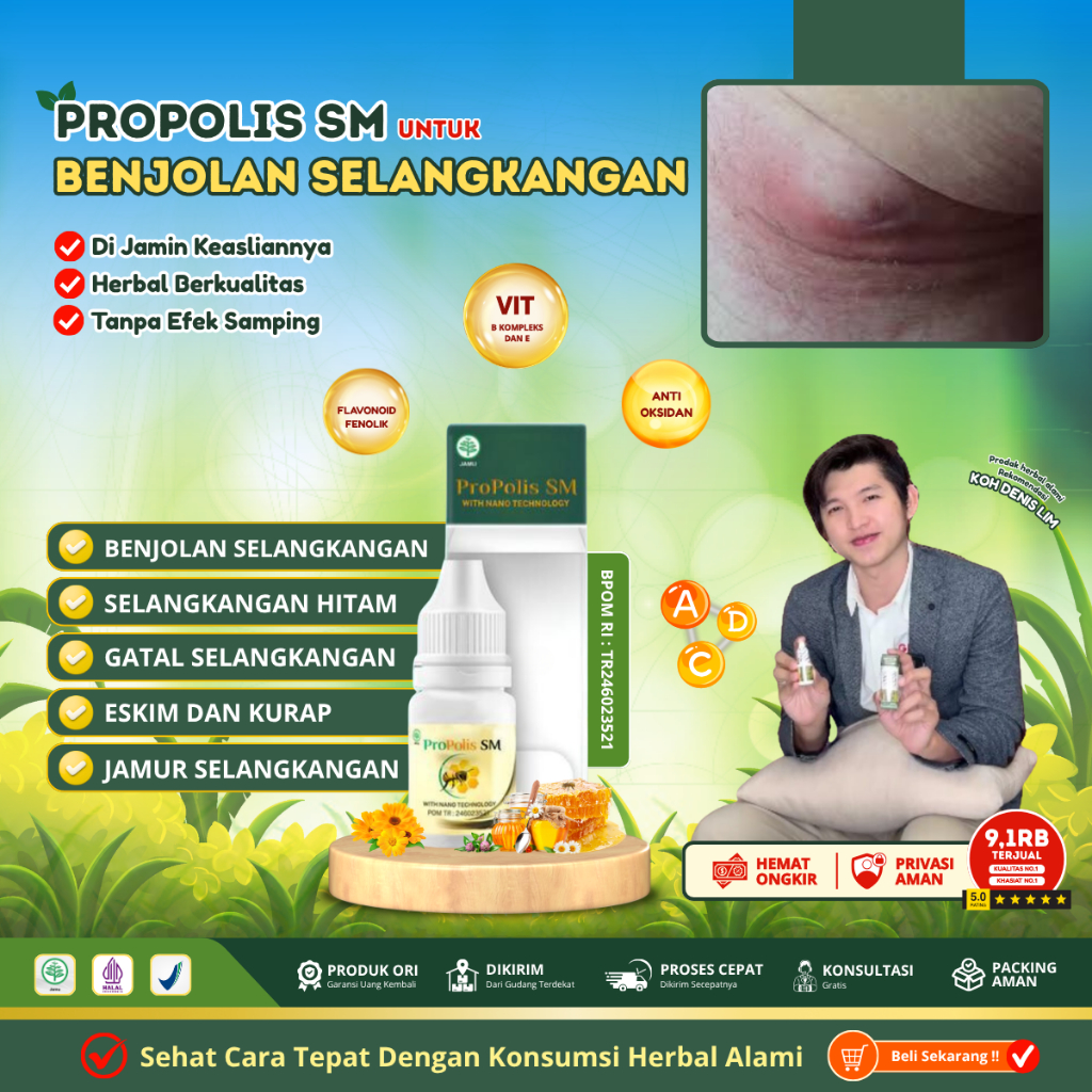 Obat Benjolan Di Selangkangan, Selangkangan Lecet , Obat Gatal Selangkangan, Penghancur Benjolan Sel