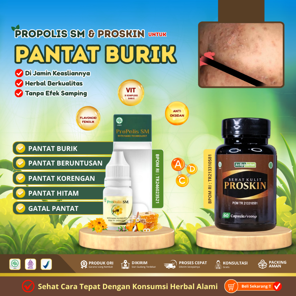Obat Pantat Gatal - Obat Pantat Bruntusan - Obat Pantat Jamur - Obat Gatal Selangkangan - Obat Bokon