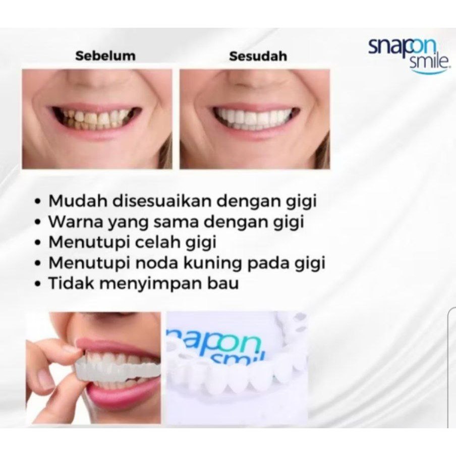 Set Pelapis Veneer GIGI