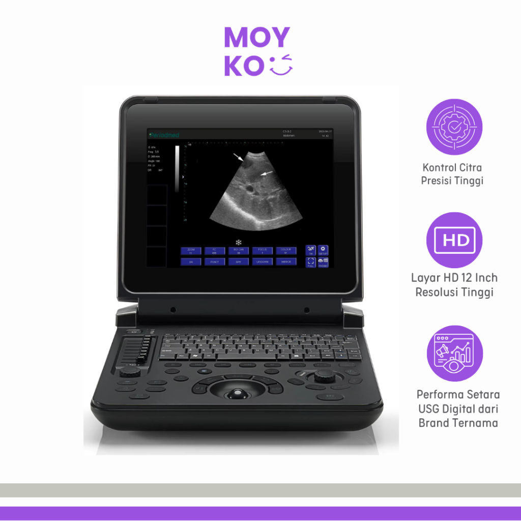 Mesin USG Digital 2D Portable Ultrasound Scanner 12 Inch