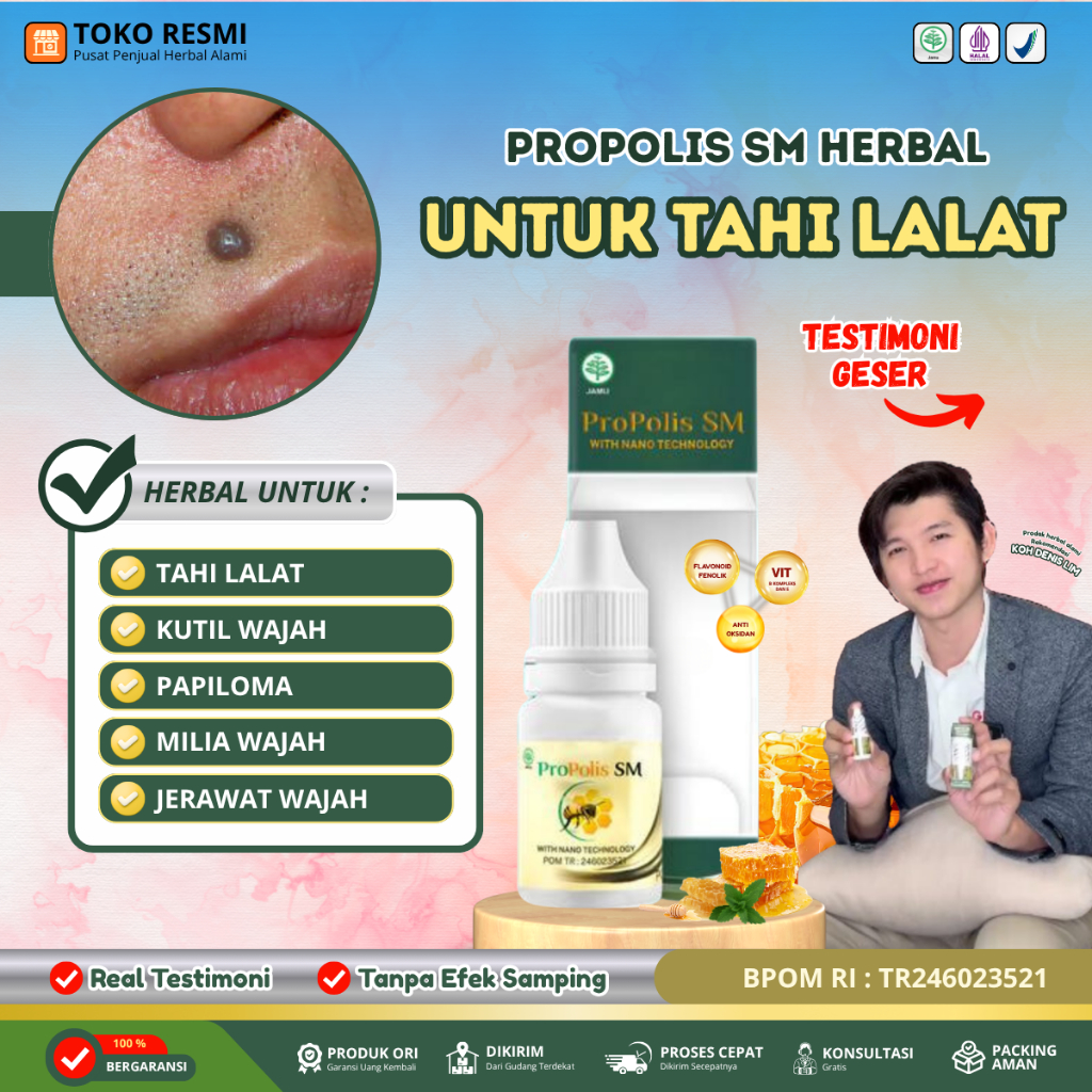 Propolis SM - Penghilang tahi lalat, Obat penghilang tahi lalat di wajah, Obat tahi lalat di wajah, 