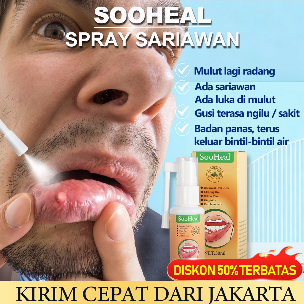 Obat kuat Obat sariawan spray sariawan 30ml Aman Untuk Anak & Dewasa Herbal alami Spray Sariawan Cep
