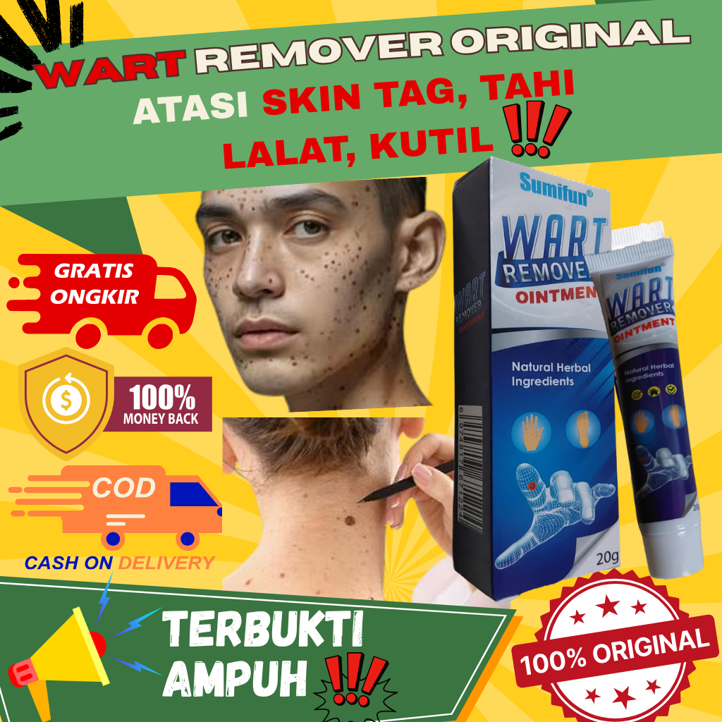[PROMO BISA COD] Cream krim Penghilang Tahi Lalat dan Kutil / EELHOE Sumifun Wart Removal Skin Tag E