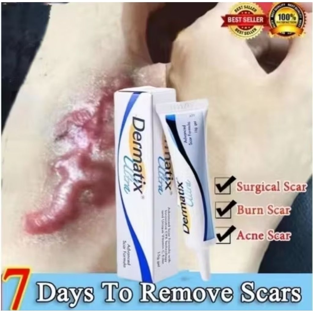 Dermatix Ultra gel 15gr penghilang bekas luka.dermatix ultra original 100%. Menghilangkan dan Menyam