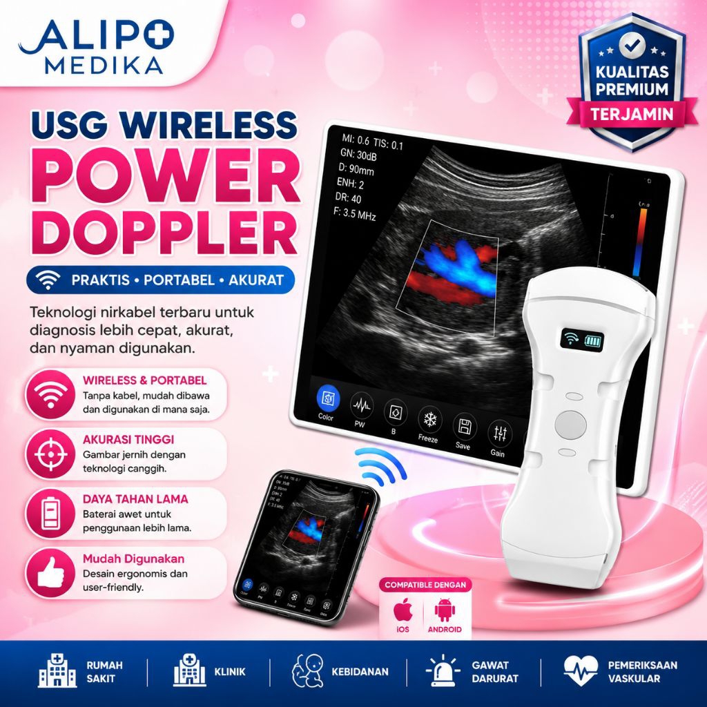 USG Wireless Portable Power Doppler Alat Scan Bayi Tanpa Kabel untuk Kesehatan Ibu dan Bayi