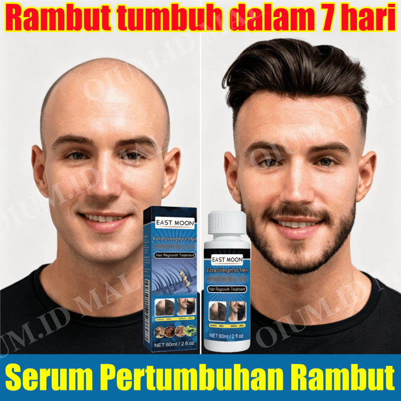Serum penumbuh rambut cepat dan tebal obat penumbuh rambut botak penumbuh rambut original 100% rambu