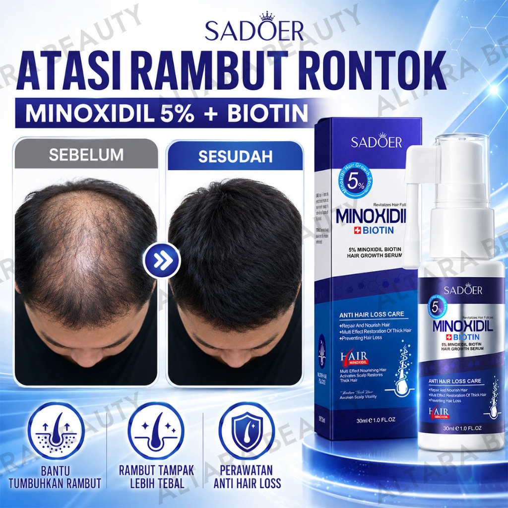 Minoxidil Spray Rambut, Serum Penumbuh Rambut, 30ml, Serum Rambut Minoxidil, Merangsang Pertumbuhan 
