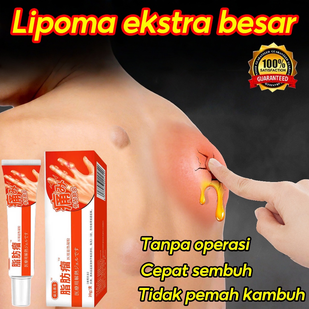 Lipoma cream Krim lipoma 20g Obat Benjolan Lipoma Obat herbal Cina Krim lipoma Salep benjolan payuda