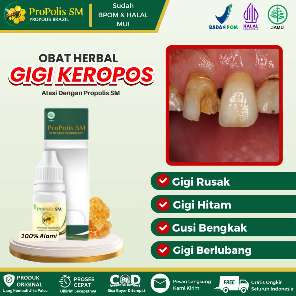 Obat Herbal Gigi Keropos, Gigi Rusak, Gigi Hitam, Gigi Berlubang Hitam, Gusi Bengkak Atasi Dengan Pr