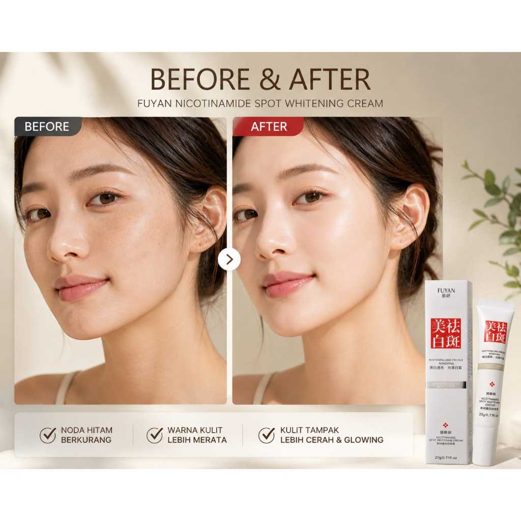 Fuyan Nicotinamide Spot Whitening Cream/Cream Pemutih penghilang Flek - 20g