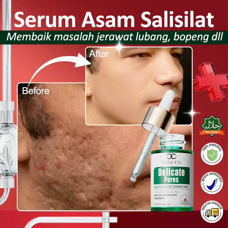 LYDIMOON Serum Asam Salisilat untuk Menghilangkan Jerawat, Salep Lubang Jerawat, Krim Perbaikan Beka