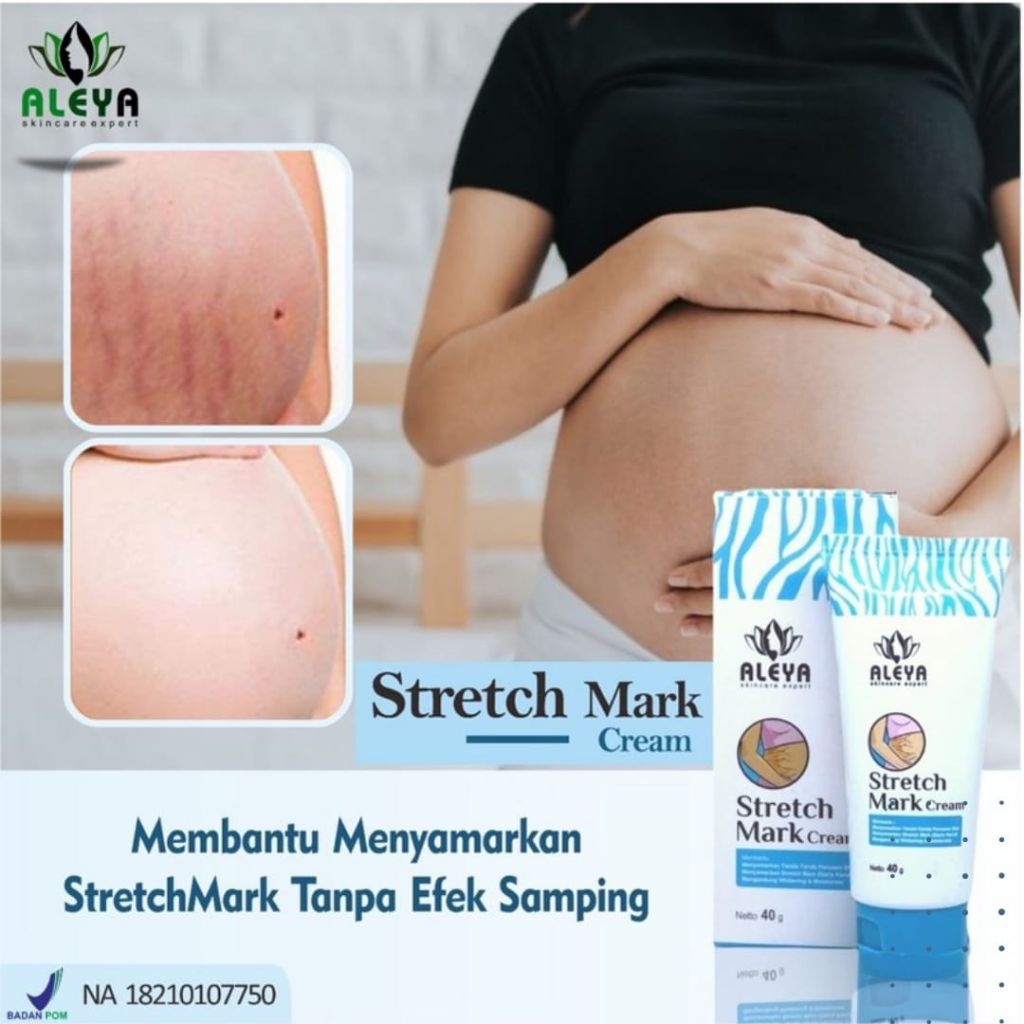ALEYA STRETCH MARK CREAM 40GR