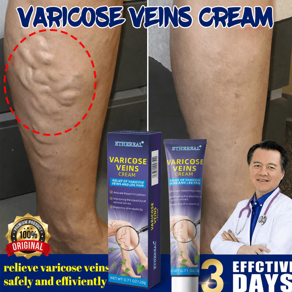Krim Varises Kaki Betis Varicose Veins Cream 20g Obat Varises Salep Varises Untuk Pegal Linu Nyeri K