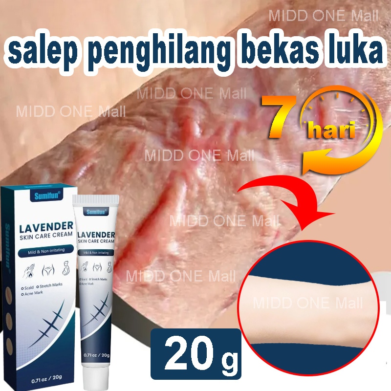 Salep Penghilang Bekas Luka Hitam Salep Bekas Luka Paling Ampuh Menghilangkan Bekas Luka Koreng Peng