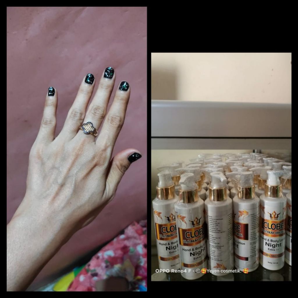 Hb Klobe Platinum original