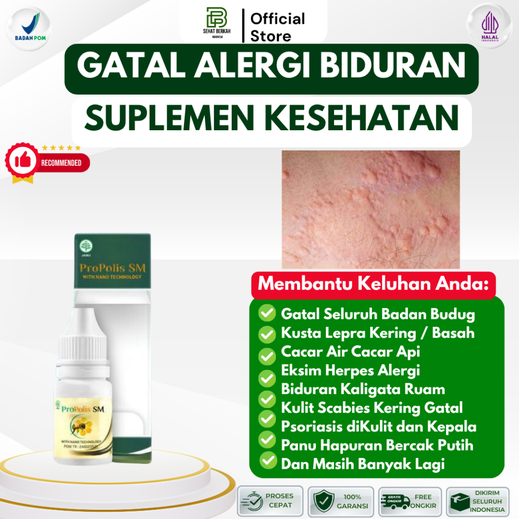 Obat Biduran Kaligata Gatal Alergi Bentol Kulit Merah Kaligata dengan PROPOLIS SM BPOM