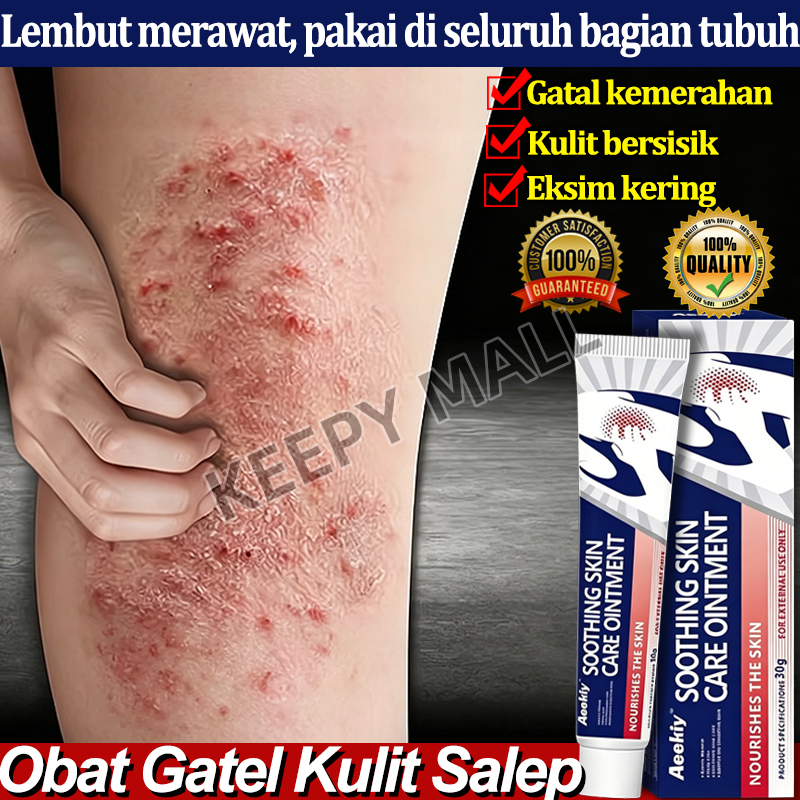 Oba Gatal Paling Ampuh Salep Eksim Kering Dan Gatal Salep Jamur Kulit Obat Kurap Gatal Gatal Kulit S