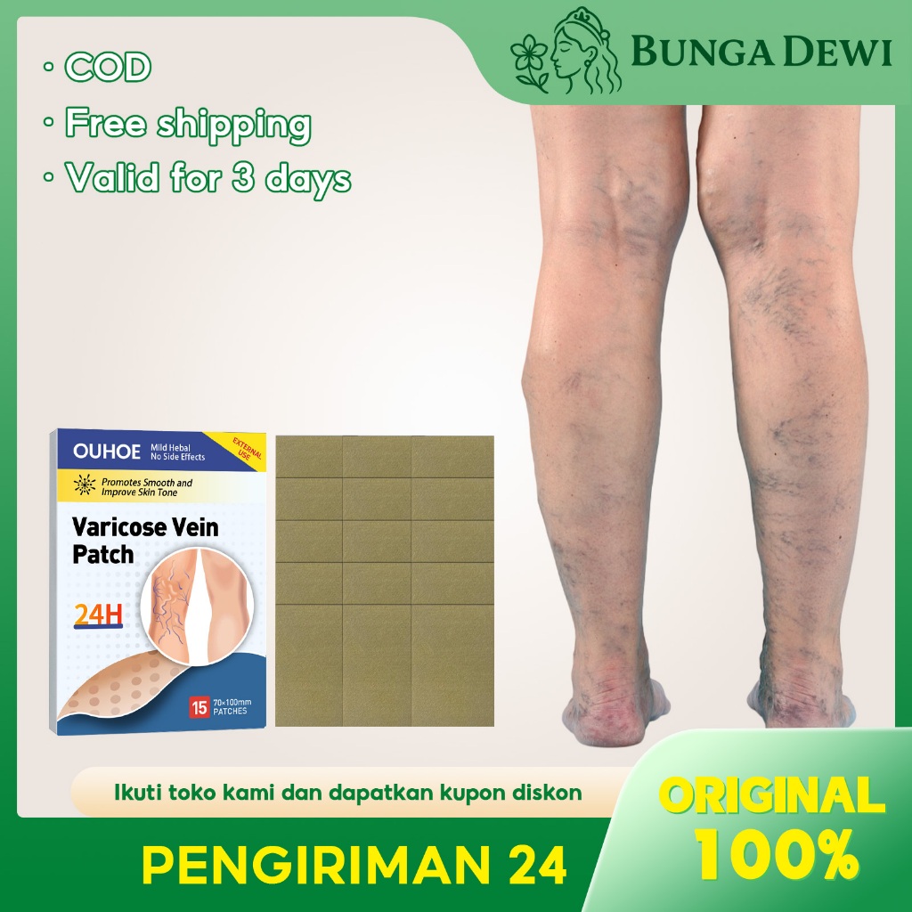 OUHOE 15pcs Koyo Varises Penghilang Varises Di Kaki Varicose Patch Obat Varises Herbal Koyo Varicose