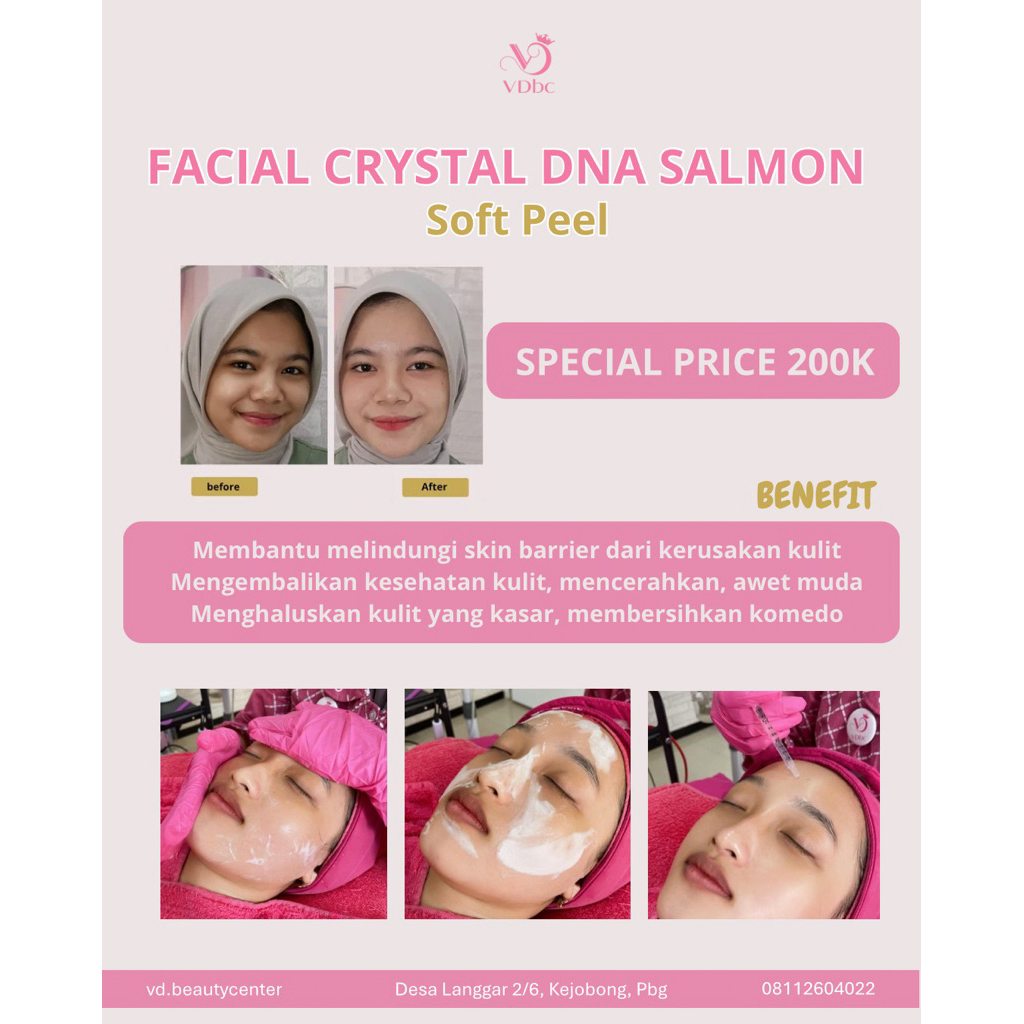 facial crystal DNA salmon soft peel