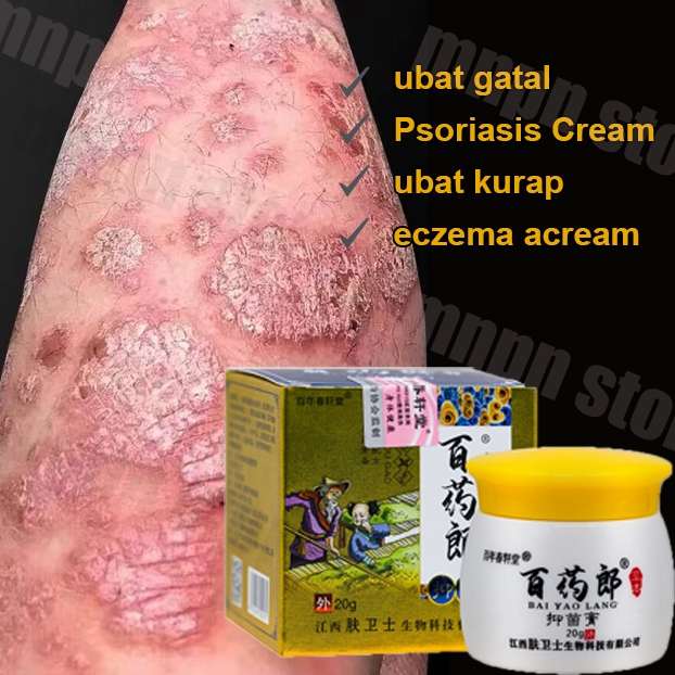 salap gatal china Salep Eksim Kering dan Gatal Salep Kurap Ampuh Cepat Hilang Obat Gatal Selangkanga