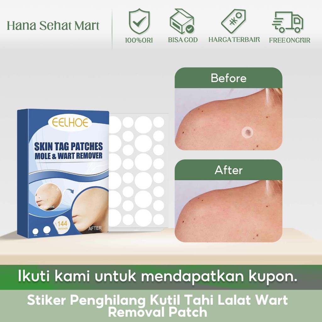 EELHOE Stiker Penghilang Kutil Tahi Lalat Wart Removal Patch 144pcs Wart Remover Skin Tag Patches Wa