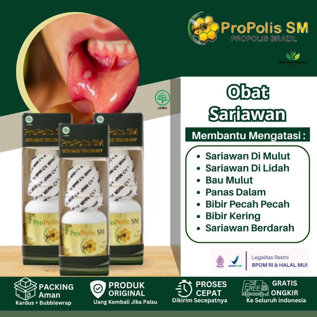 Obat Sariawan Di Bibir Dan Lidah Atasi Bau Mulut Bibir Kering Dan Pecah Pecah Panas Dalam Lidah Berj