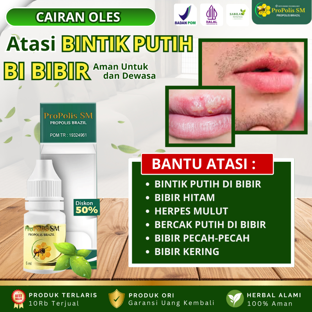 Perawatan Bintik Putih Di Bibir, Penghilang Bintik Putih Di Bibir / Forduce Spots, Herpes Bibir, Bib