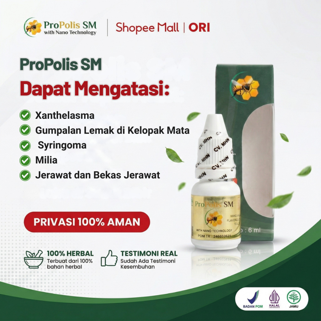 Obat Gumpalan Lemak di Kelopak Mata Penghilang Xanthelasma Syringoma Milia dengan Propolis SM