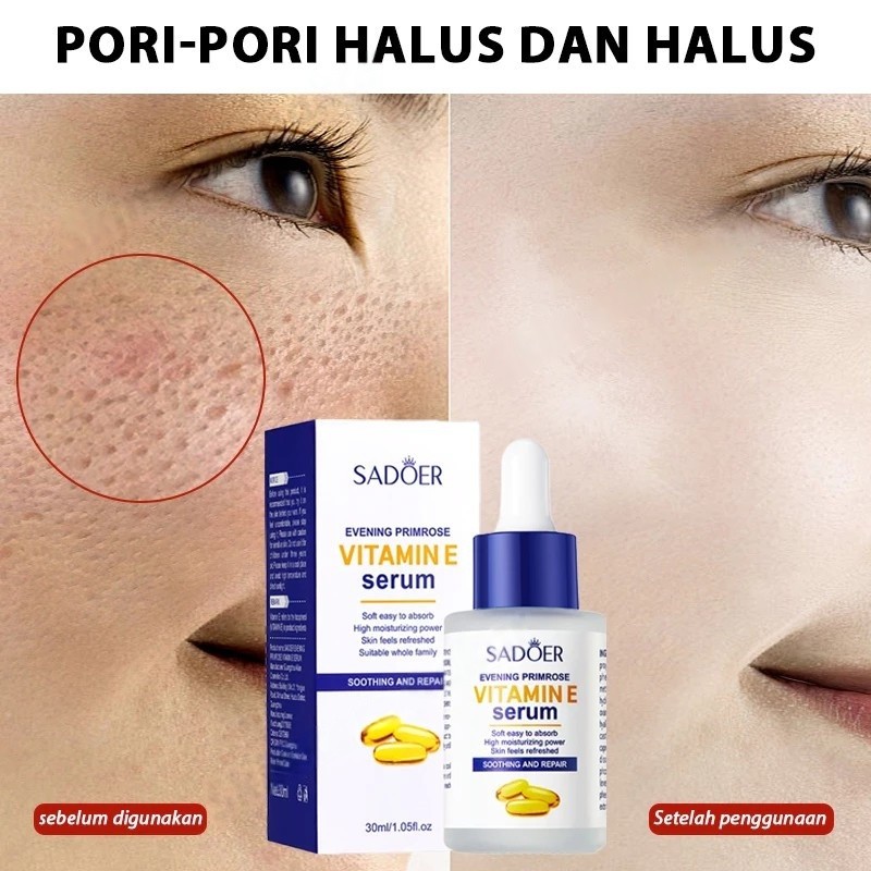 SADOER Pengecil Pori-Pori Flek Pelembab Dan Pemutih Mengecilkan Vitamin E Pemutih Bercahaya Mengecil